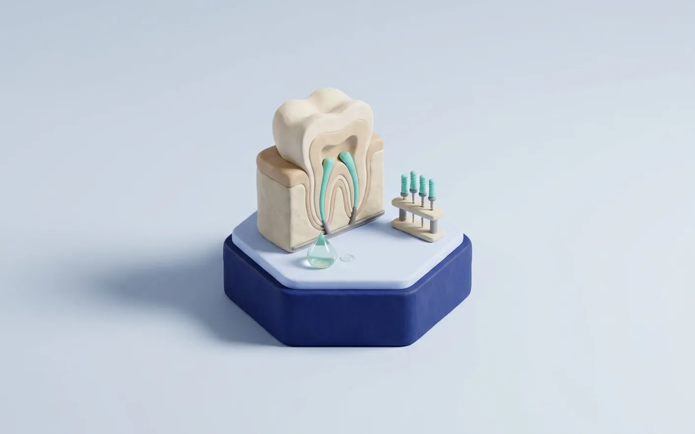 Quando serve la devitalizzazione di un dente? Foto dello studio di Via Tripoli.