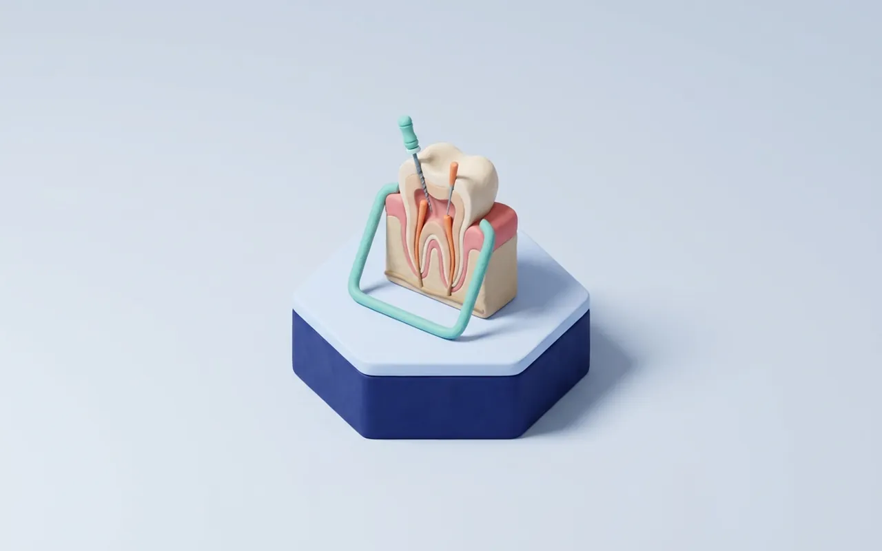Dente devitalizzato durante la cura dei canali in uno studio di endodonzia a Montecatini Terme