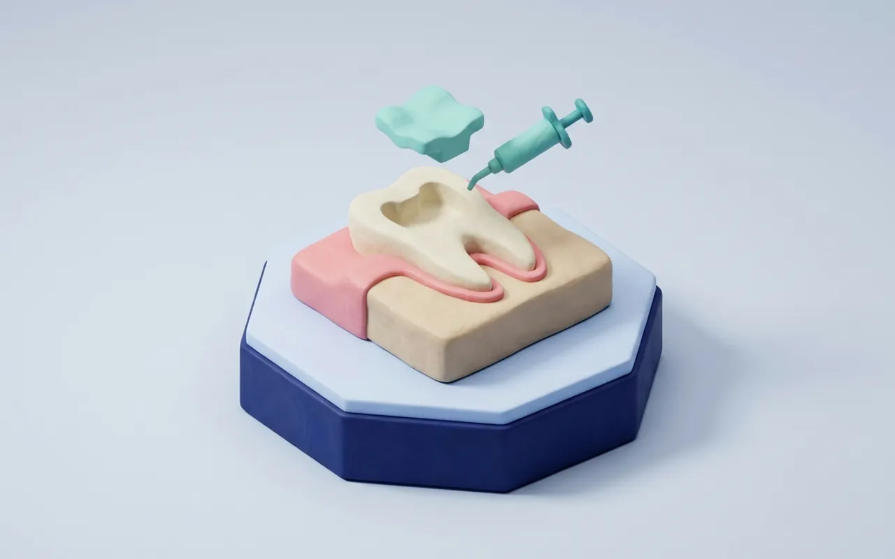 Molare con restauro in ceramica per spiegare intarsio dentale svantaggi e limiti